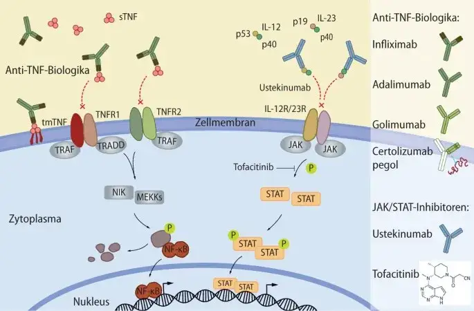 JAK-Inhibitoren Wirkmechanismus Morbus Crohn
