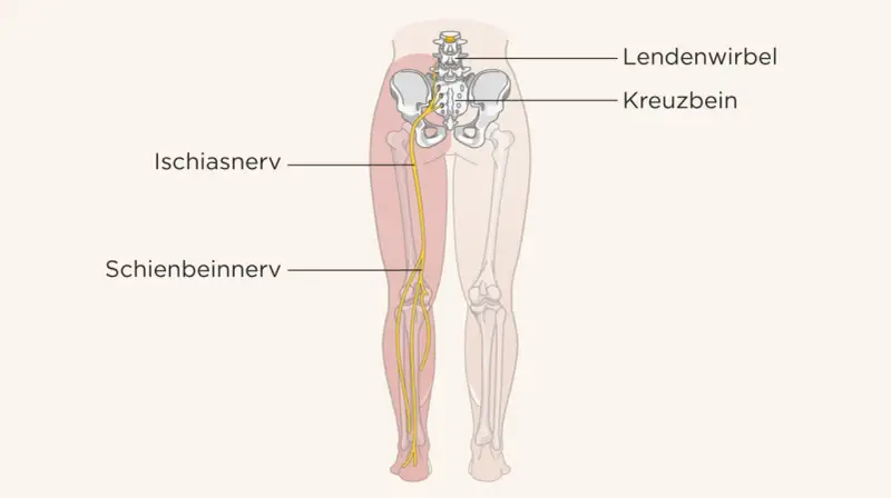 Illustration zeigt den Ischiasnerv, der vom Lendenwirbelbereich über das Kreuzbein bis ins Bein verläuft. Eine Massage kann hier Linderung verschaffen.